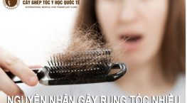 nguyên nhân gây rụng tóc nhiều