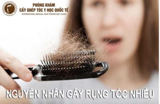 nguyên nhân gây rụng tóc nhiều