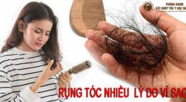 rụng tóc nhiều