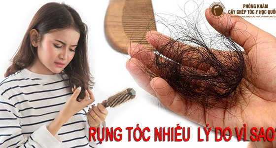rụng tóc nhiều