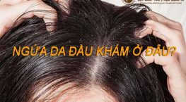 ngứa da đầu khám ở đâu