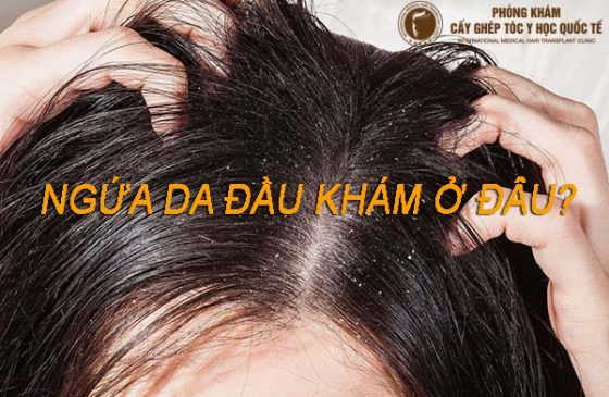 ngứa da đầu khám ở đâu