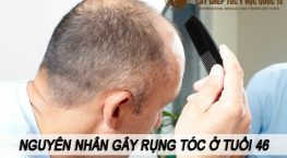 nguyên nhân gây rụng tóc ở tuổi 46