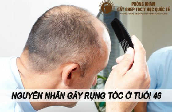 nguyên nhân gây rụng tóc ở tuổi 46