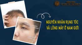 nguyên nhân rụng tóc và lông mày ở nam giới