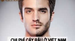 chi phí cấy râu