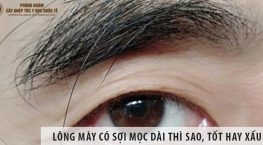 vài sợi lông mày mọc dài bất thường