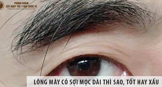 vài sợi lông mày mọc dài bất thường