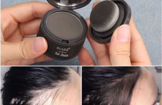 bột phủ tóc hói