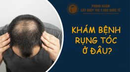 khám bệnh hói đầu ở đâu