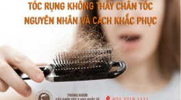 tóc rụng không thấy chân tóc