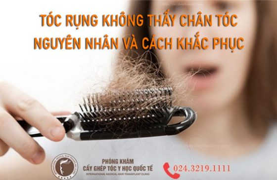 tóc rụng không thấy chân tóc