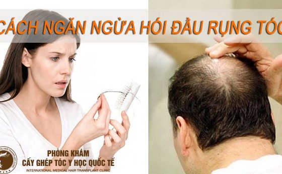 cách ngăn ngừa hói đầu