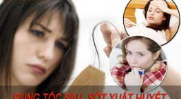 rụng tóc sau sốt xuất huyết