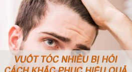 vuốt tóc nhiều bị hói