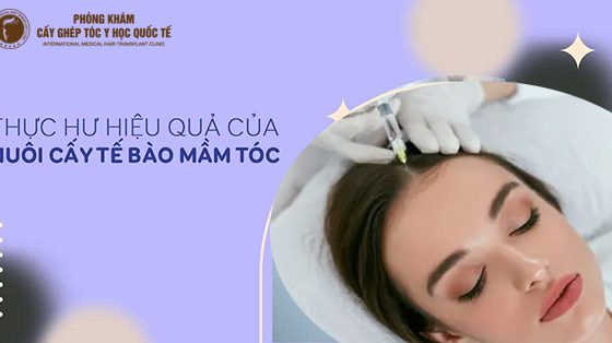 nuôi cấy tế bào mầm tóc