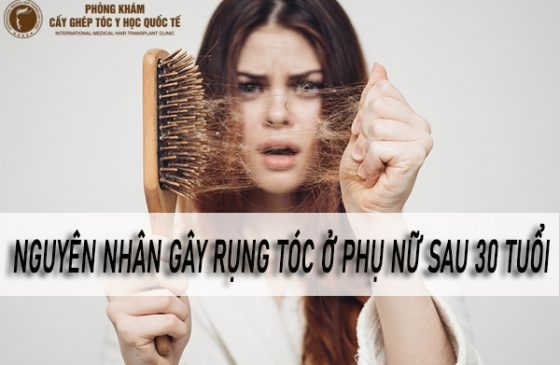 Nguyên nhân gây rụng tóc ở phụ nữ sau 30 tuổi
