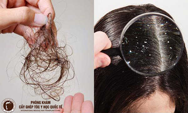 những tác hại của dầu xả tóc khi dùng sai cách