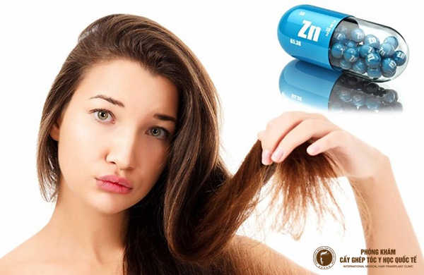 rụng tóc nhiều cần bổ sung chất gì