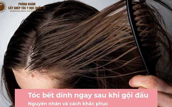 tóc bết dính
