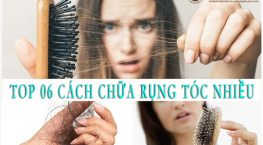cách chữa rụng tóc nhiều