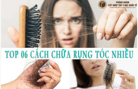 cách chữa rụng tóc nhiều