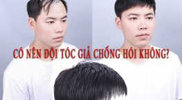 Giải đáp: Nam giới có nên đội tóc giả chống hói hay không?