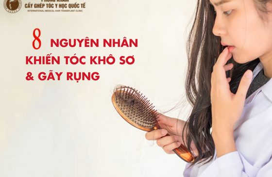 nguyên nhân dẫn đến tóc khô xơ và rụng nhiều