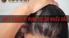 [Bật mí] TOP 5 Cách trị rụng tóc do nhiều dầu hiệu quả nhất hiện nay