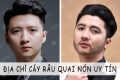 địa chỉ cấy râu quai nón