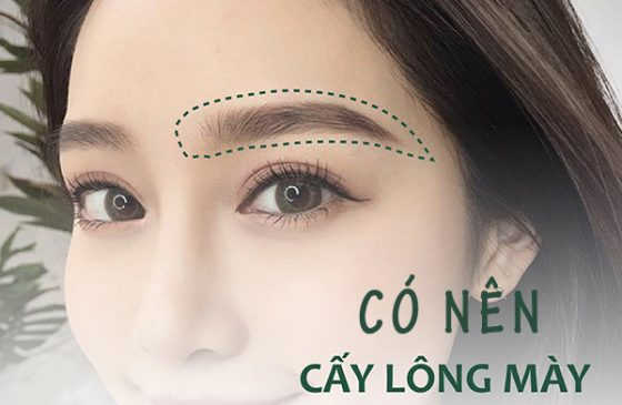có nên cấy lông mày không