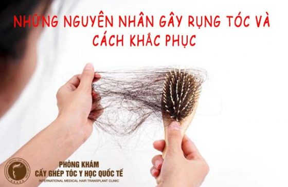những nguyên nhân gây rụng tóc và cách khắc phục