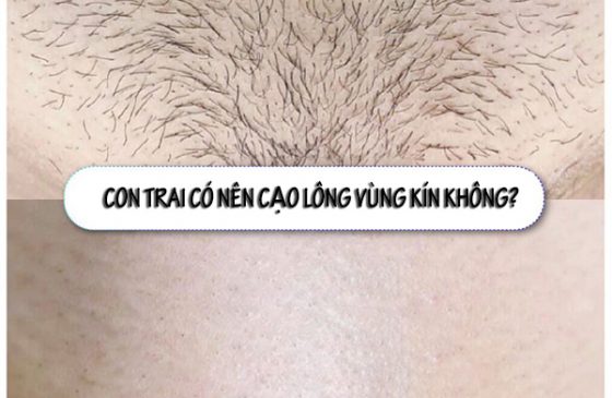 con trai có nên cạo lông vùng kín không