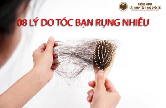 lý do tóc bạn rụng nhiều