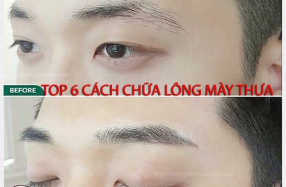 cách chữa lông mày thưa