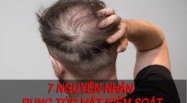 07 Nguyên nhân rụng tóc mất kiểm soát và cách khắc phục tận gốc