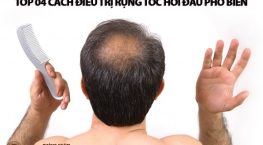 Giải pháp trị rụng tóc hói đầu hiệu quả cho cả nam và nữ – Bạn đừng bỏ lỡ!