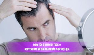 Rụng tóc ở nam giới tuổi 30: Nguyên nhân và giải pháp khắc phục hiệu quả