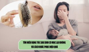 Tìm hiểu rụng tóc sau sinh có mọc lại không và cách khắc phục hiệu quả