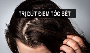 Hé lộ bí quyết trị dứt điểm tóc bết hiệu quả bất ngờ