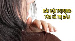 Top 7 loại dầu gội trị rụng tóc và trị gàu hiệu quả bạn có thể thử