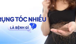 Rụng tóc là dấu hiệu của bệnh gì? Cách khắc phục rụng tóc bệnh lý hiệu quả