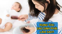 Rụng tóc sau sinh phải làm sao? Cách khắc phục hiệu quả