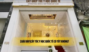 [Giải đáp]Cấy tóc y học quốc tế có tốt không?