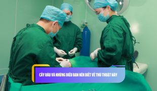 Cấy râu và những điều bạn nên biết về thủ thuật này 
