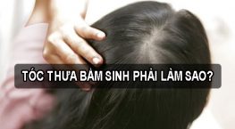 [Tư Vấn] Tóc Thưa Bẩm Sinh Khắc Phục Như Thế Nào Hiệu Quả?