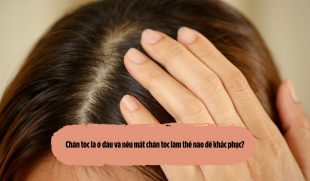 Chân tóc là ở đâu và nếu mất chân tóc làm thế nào để khắc phục?