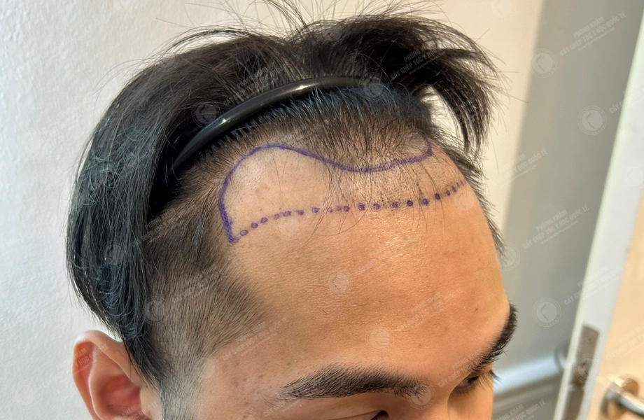 Nguyễn Minh Tuấn -  3