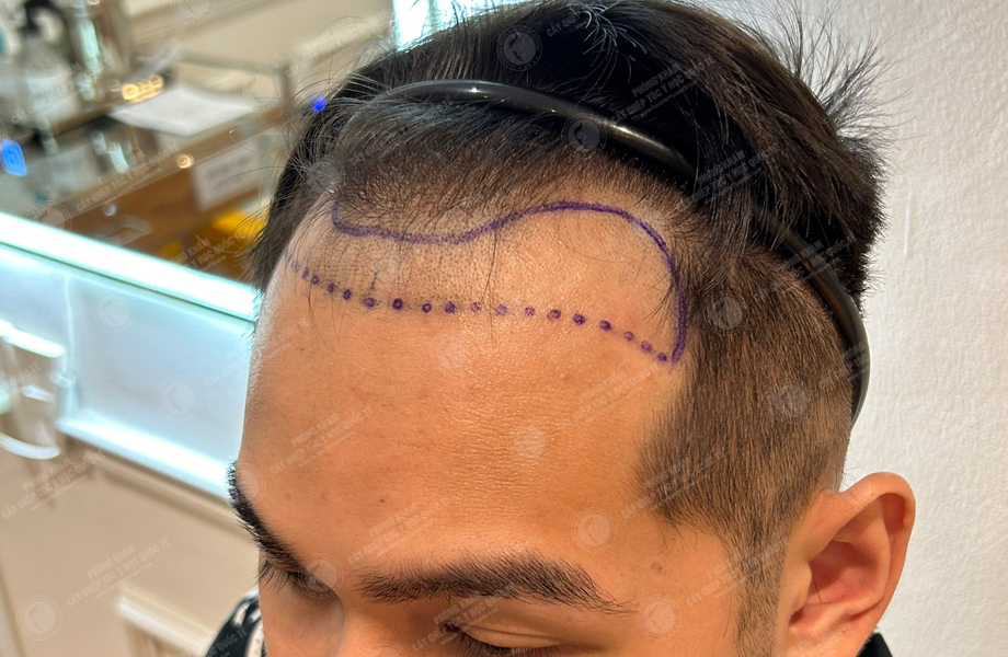 Nguyễn Minh Tuấn -  4
