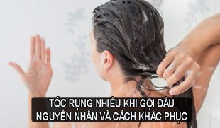 Tóc rụng nhiều khi gội và cách xử lý hiệu quả